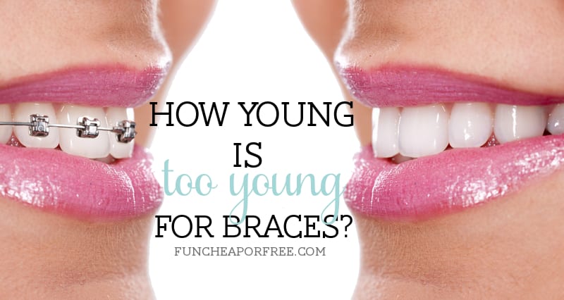 How young is TOO young for braces? Fun Cheap or Free